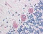 KIAA0152 / MLEC Antibody (N-Terminus)